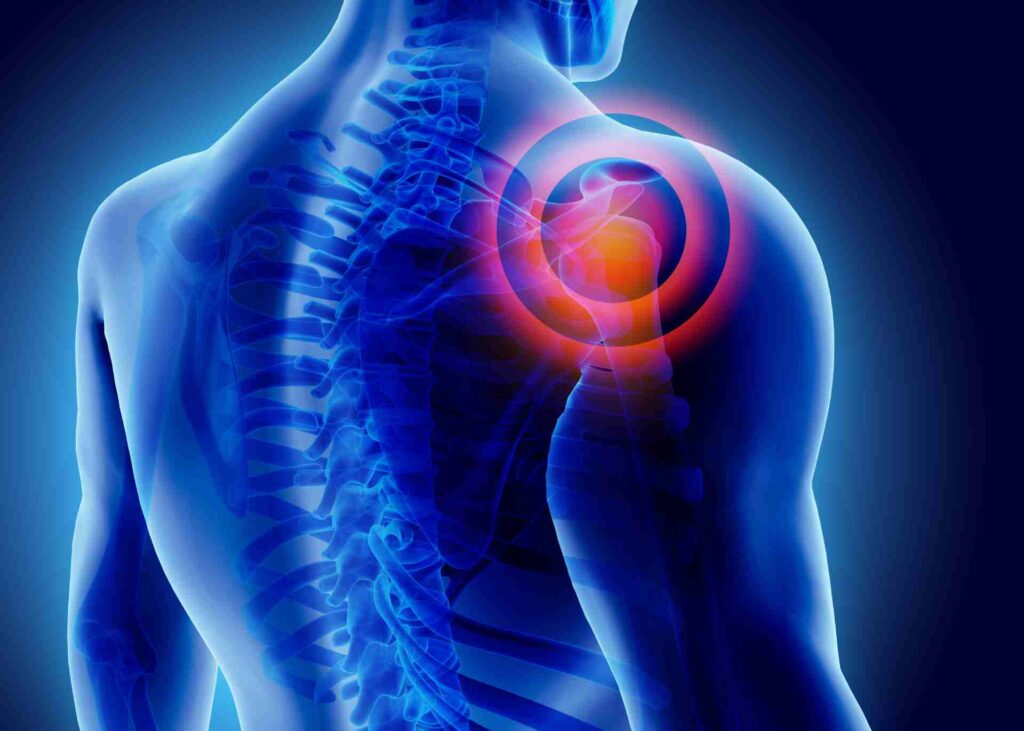 Shoulder pain and its remedial measures
